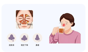鼻窦炎防治的中医智慧与现代方案