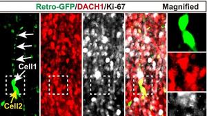 人类大脑中发现全新神经干细胞