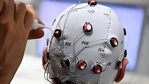 脑机接口进入临床应用