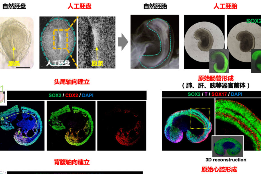 世界首个人类胚盘样原肠模型构建成功